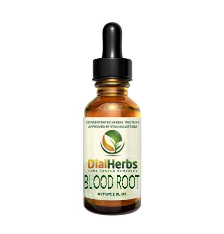 A bottle of blood root tincture